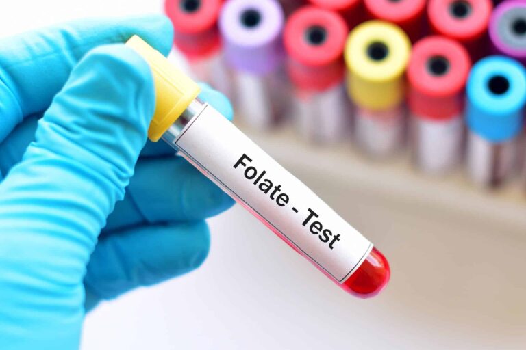 What is Folate Blood Test?