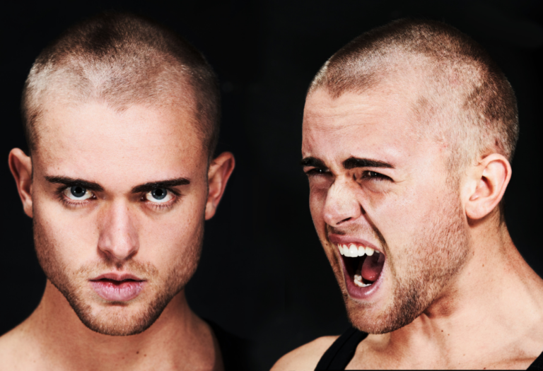 Signs of Bipolar Disorder in Young Men